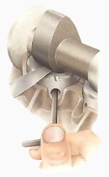 Indirect acting overhead cam